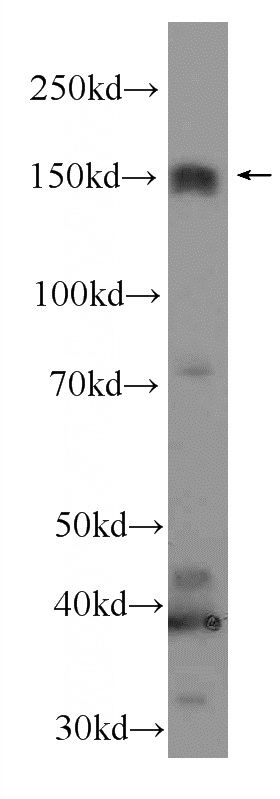 HeLa cells were subjected to SDS PAGE followed by western blot with Catalog No:111878(JAG2 Antibody) at dilution of 1:500