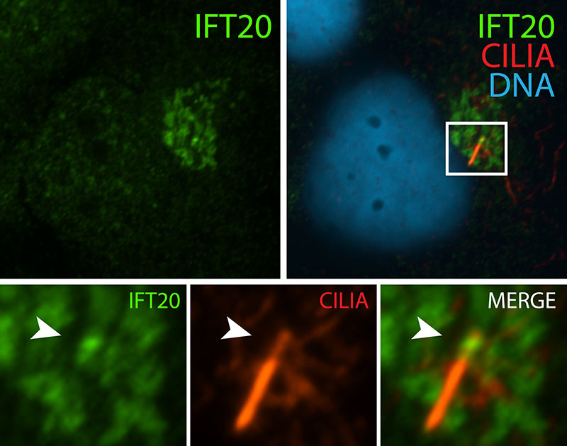 IF result (localization to Golgi-like structures) of anti-IFT20 (Catalog No:111665, 1:50) with serum-starved hTERT-RPE1 (MoTH fixed) by Dr. Moshe Kim.