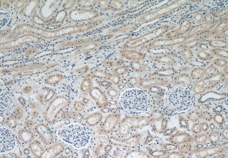 Immunohistochemical of paraffin-embedded human kidney using Catalog No:107326(NDUFS5 antibody) at dilution of 1:50 (under 10x lens)