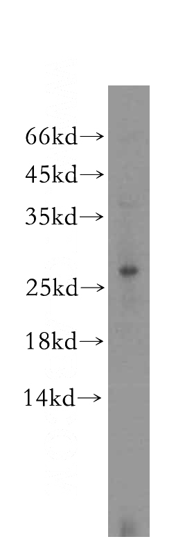HeLa cells were subjected to SDS PAGE followed by western blot with Catalog No:110099(DNAJB8 antibody) at dilution of 1:500