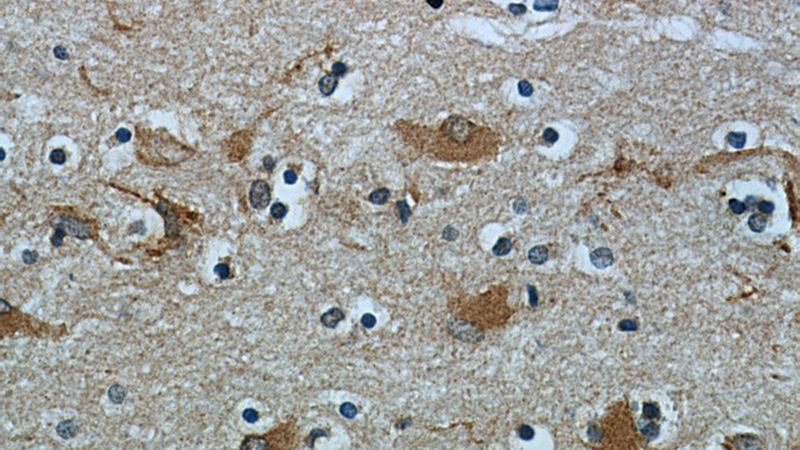 Immunohistochemical of paraffin-embedded human brain using Catalog No:113333(OGFOD2 antibody) at dilution of 1:50 (under 40x lens)