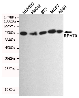Western blot detection of RPA70 in HUVEC,Hacat,3T3,MCF7 and A549 cell lysates using RPA70 mouse mAb (1:2000 diluted).Predicted band size:70KDa.Observed band size:70KDa.