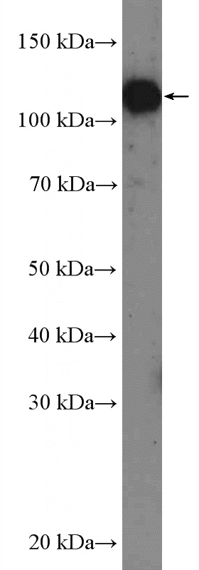 HeLa cells were subjected to SDS PAGE followed by western blot with Catalog No:116402(TROAP Antibody) at dilution of 1:300