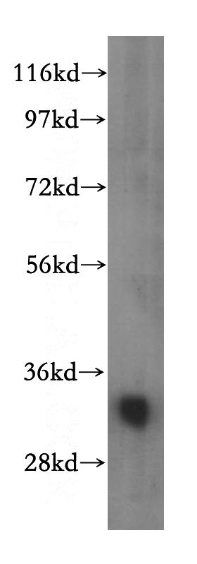 human kidney tissue were subjected to SDS PAGE followed by western blot with Catalog No:116714(VAPA antibody) at dilution of 1:500