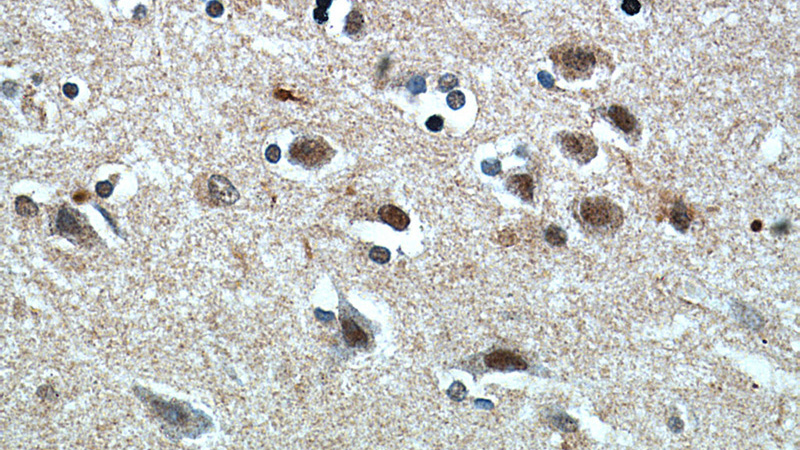 Immunohistochemical of paraffin-embedded human brain using Catalog No:113972(PLK5P antibody) at dilution of 1:50 (under 40x lens)