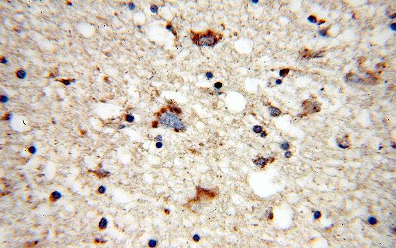 Immunohistochemical of paraffin-embedded human brain using Catalog No:112479(MARK2 antibody) at dilution of 1:50 (under 40x lens)