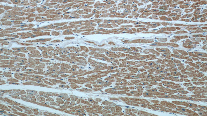 Immunohistochemical of paraffin-embedded human heart using Catalog No:114111(PPP3CB antibody) at dilution of 1:50 (under 10x lens)