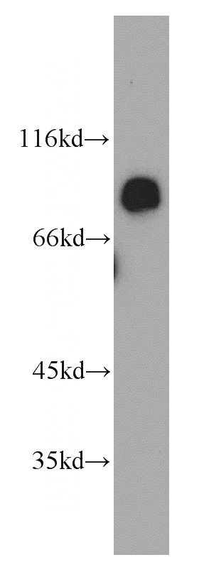 HepG2 cells were subjected to SDS PAGE followed by western blot with Catalog No:112596(MGAT5B antibody) at dilution of 1:500