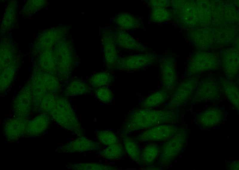 Immunofluorescent analysis of (10% Formaldehyde) fixed HeLa cells using Catalog No:113188(NIPBL Antibody) at dilution of 1:50 and Alexa Fluor 488-congugated AffiniPure Goat Anti-Rabbit IgG(H+L)