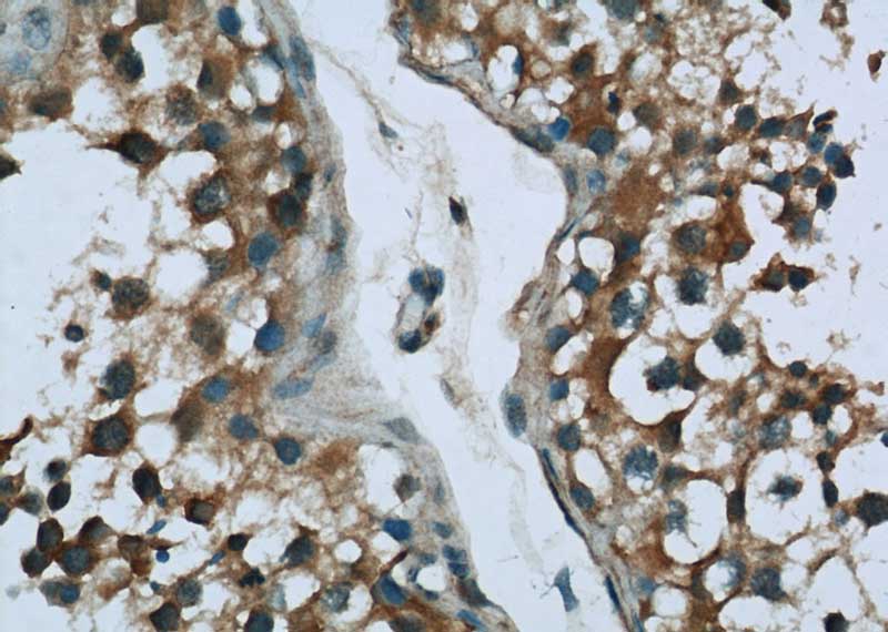 Immunohistochemistry of paraffin-embedded human testis tissue slide using Catalog No:116661(UBQLNL Antibody) at dilution of 1:50