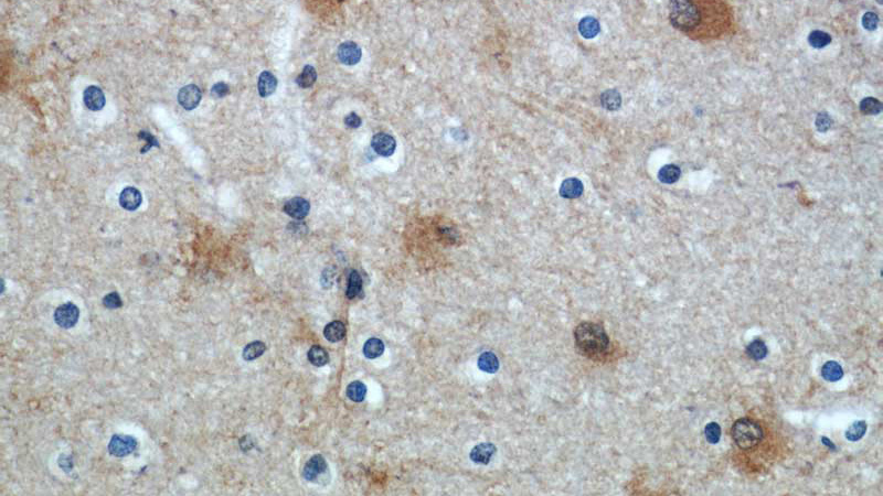 Immunohistochemical of paraffin-embedded human brain using Catalog No:110158(SLC1A2 antibody) at dilution of 1:50 (under 40x lens)