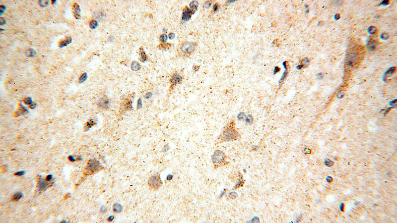 Immunohistochemical of paraffin-embedded human brain using Catalog No:111605(IDH3A antibody) at dilution of 1:100 (under 40x lens)