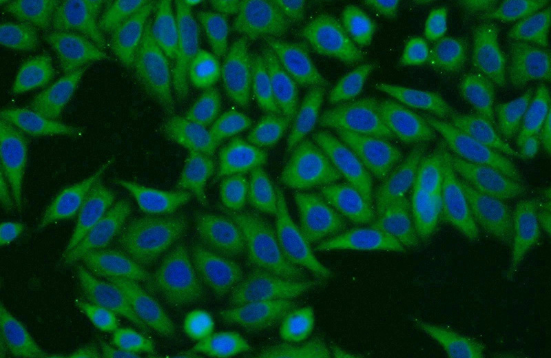 Immunofluorescent analysis of HepG2 cells using Catalog No:114711(RINT1 Antibody) at dilution of 1:25 and Alexa Fluor 488-congugated AffiniPure Goat Anti-Rabbit IgG(H+L)