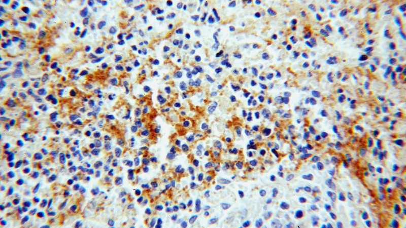 Immunohistochemical of paraffin-embedded human spleen using Catalog No:107773(ADAP2 antibody) at dilution of 1:50 (under 40x lens)