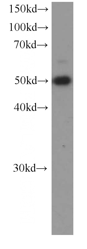 Jurkat cells were subjected to SDS PAGE followed by western blot with Catalog No:107590(SMARCE1 Antibody) at dilution of 1:1000