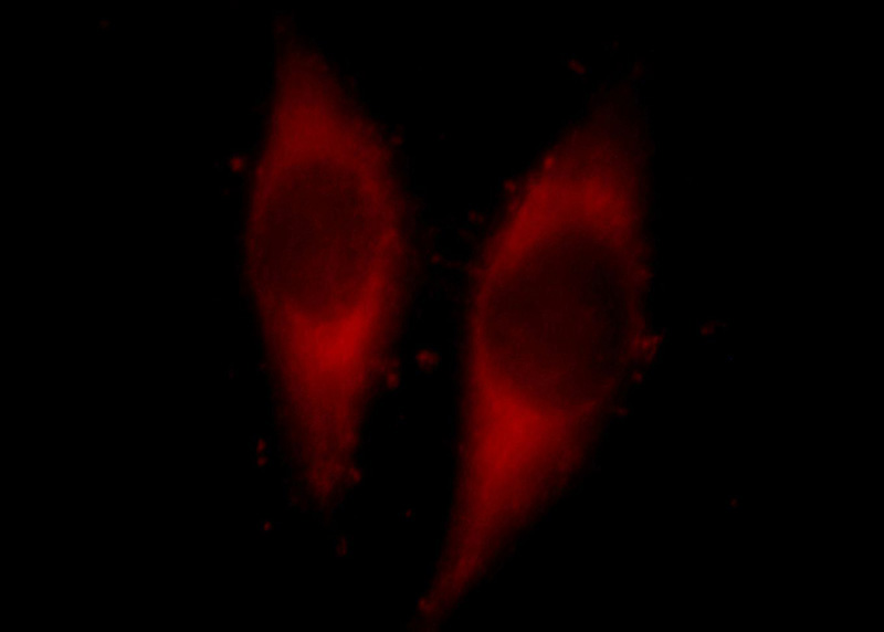 Immunofluorescent analysis of Hela cells, using PTGES2 antibody Catalog No:114270 at 1:25 dilution and Rhodamine-labeled goat anti-rabbit IgG (red).