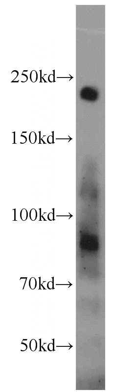 rat testis tissue were subjected to SDS PAGE followed by western blot with Catalog No:112118(KRAP, SSFA2 antibody) at dilution of 1:600