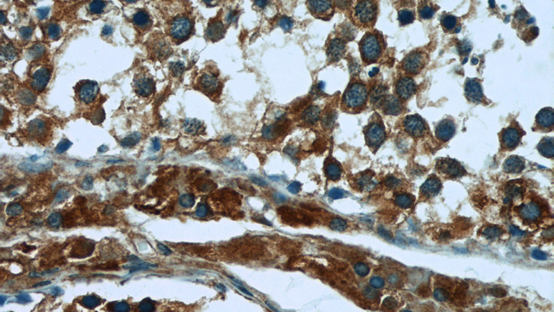 Immunohistochemistry of paraffin-embedded human testis tissue slide using Catalog No:110502(SEC10 Antibody) at dilution of 1:50 (under 40x lens)