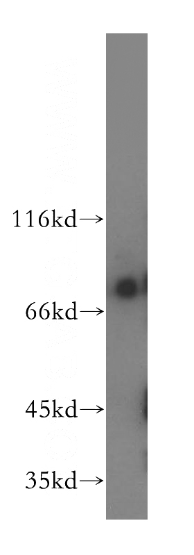 human liver tissue were subjected to SDS PAGE followed by western blot with Catalog No:114125(PPIG antibody) at dilution of 1:400
