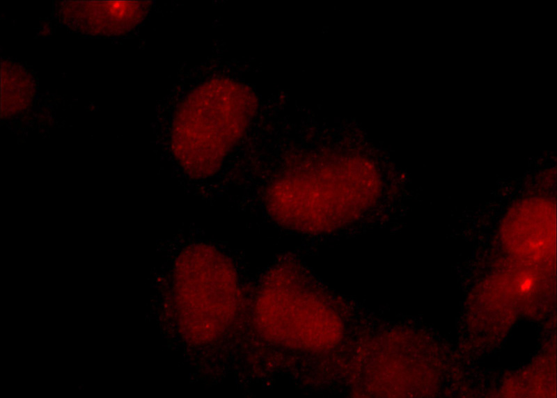 Immunofluorescent analysis of HEK-293 cells using Catalog No:109545(CREB1 Antibody) at dilution of 1:25 and Rhodamine-Goat anti-Rabbit IgG
