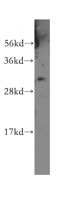 human skin tissue were subjected to SDS PAGE followed by western blot with Catalog No:112193(LENG1 antibody) at dilution of 1:500