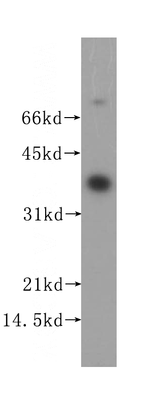 HepG2 cells were subjected to SDS PAGE followed by western blot with Catalog No:115681(STARD7 antibody) at dilution of 1:500