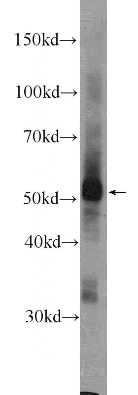 mouse brain tissue were subjected to SDS PAGE followed by western blot with Catalog No:108676(C1orf27 Antibody) at dilution of 1:300