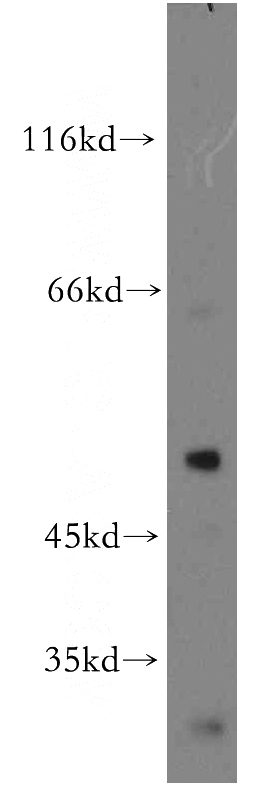 MCF7 cells were subjected to SDS PAGE followed by western blot with Catalog No:116882(YBX1 antibody) at dilution of 1:500