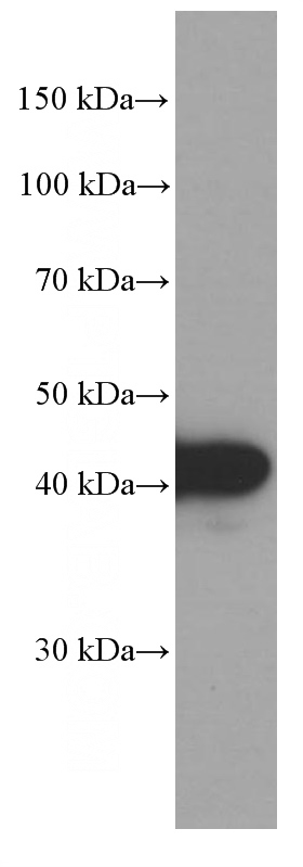 SW 1990 cells were subjected to SDS PAGE followed by western blot with Catalog No:107543(VPS37A Antibody) at dilution of 1:2000