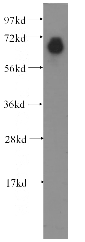 human ileum tissue were subjected to SDS PAGE followed by western blot with Catalog No:110645(FGL2 antibody) at dilution of 1:400