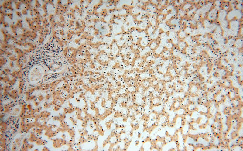 Immunohistochemical of paraffin-embedded human liver using Catalog No:112817(MRPL21 antibody) at dilution of 1:100 (under 10x lens)