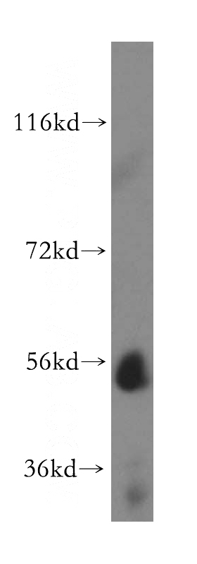 human liver tissue were subjected to SDS PAGE followed by western blot with Catalog No:116558(UGT2B4 antibody) at dilution of 1:500