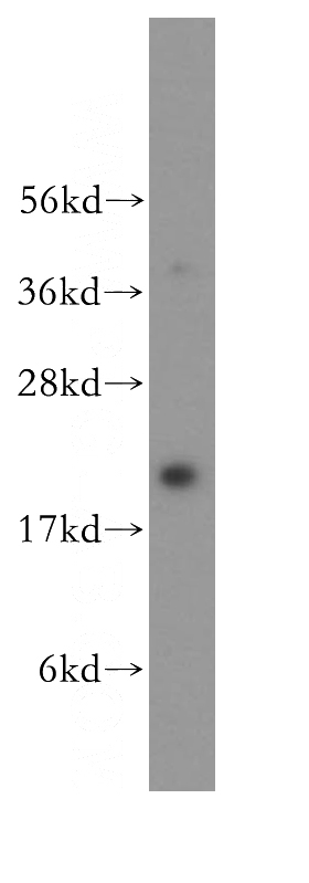 HeLa cells were subjected to SDS PAGE followed by western blot with Catalog No:114463(RAB9A antibody) at dilution of 1:300