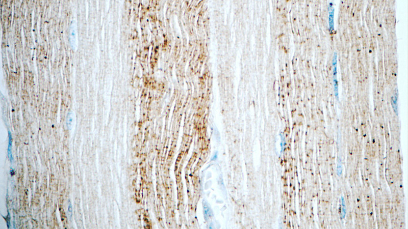 Immunohistochemistry of paraffin-embedded human skeletal muscle tissue slide using Catalog No:107771(ADAMTSL4 Antibody) at dilution of 1:50 (under 40x lens)