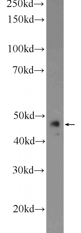 mouse liver tissue were subjected to SDS PAGE followed by western blot with Catalog No:115623(ST3GAL3 Antibody) at dilution of 1:300