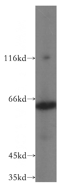 COLO 320 cells were subjected to SDS PAGE followed by western blot with Catalog No:113500(PAK4 antibody) at dilution of 1:800