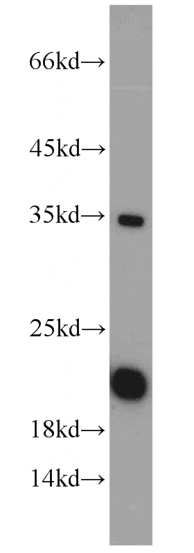 HeLa cells were subjected to SDS PAGE followed by western blot with Catalog No:115816(SUB1 antibody) at dilution of 1:1000