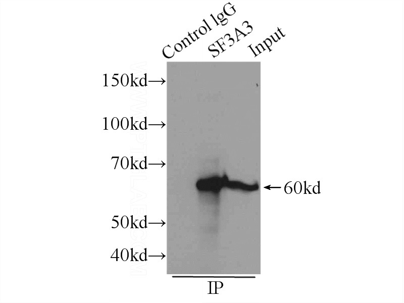 IP Result of anti-SF3A3 (IP:Catalog No:115135, 4ug; Detection:Catalog No:115135 1:600) with Raji cells lysate 2000ug.