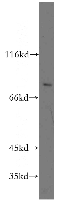 mouse lung tissue were subjected to SDS PAGE followed by western blot with Catalog No:109481(PTGS1 antibody) at dilution of 1:200