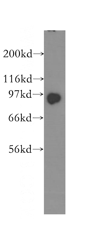 human brain tissue were subjected to SDS PAGE followed by western blot with Catalog No:112052(KIFAP3 antibody) at dilution of 1:600