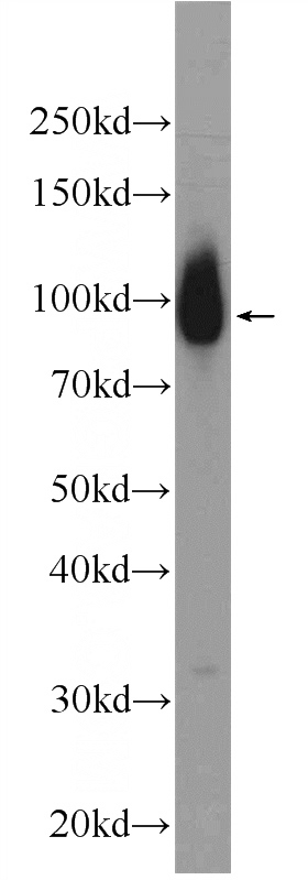 HeLa cells were subjected to SDS PAGE followed by western blot with Catalog No:110156(E2F7 Antibody) at dilution of 1:600