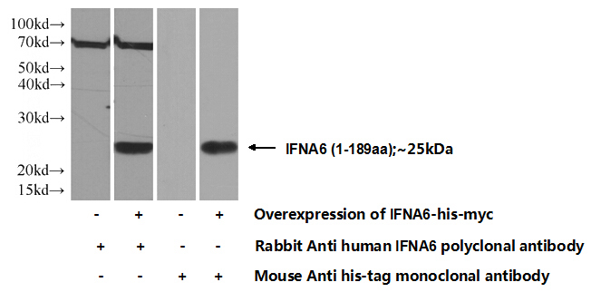 Transfected HEK-293 cells were subjected to SDS PAGE followed by western blot with Catalog No:111625(IFNA6 Antibody) at dilution of 1:1000