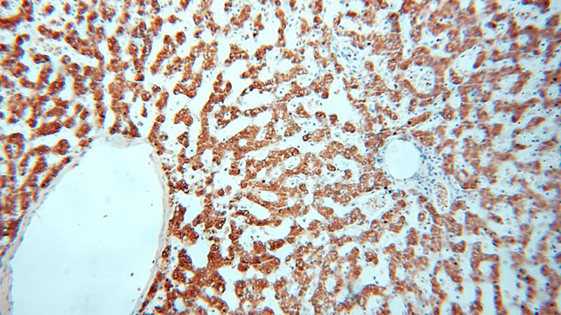 Immunohistochemical of paraffin-embedded human liver using Catalog No:109192(CES1 antibody) at dilution of 1:200 (under 10x lens)