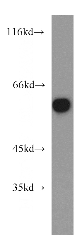 mouse skeletal muscle tissue were subjected to SDS PAGE followed by western blot with Catalog No:112437(MAPK7 antibody) at dilution of 1:300