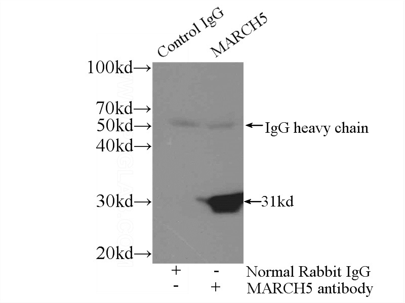 IP Result of anti-MARCH5 (IP:Catalog No:112445, 3ug; Detection:Catalog No:112445 1:300) with HeLa cells lysate 1800ug.