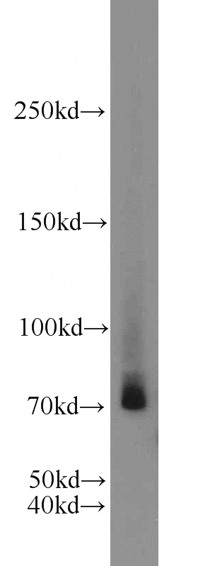 SH-SY5Y cells were subjected to SDS PAGE followed by western blot with Catalog No:109320(CIRH1A antibody) at dilution of 1:1000