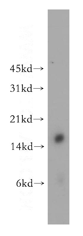 human spleen tissue were subjected to SDS PAGE followed by western blot with Catalog No:109536(CRABP1 antibody) at dilution of 1:500