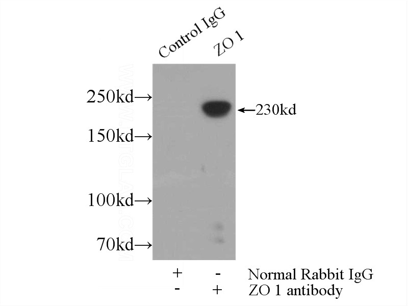 IP Result of anti-ZO1 (IP:Catalog No:117259, 5ug; Detection:Catalog No:117259 1:800) with HEK-293 cells lysate 1800ug.