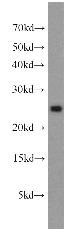 HepG2 cells were subjected to SDS PAGE followed by western blot with Catalog No:111027(GLO1 antibody) at dilution of 1:1000