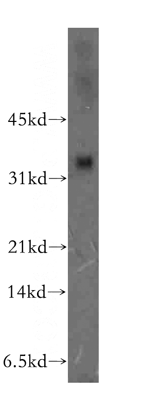 Jurkat cells were subjected to SDS PAGE followed by western blot with Catalog No:116567(ULBP2 antibody) at dilution of 1:400